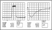 Optical Pulse Traces